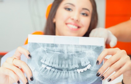 Відкритий і закритий синус ліфтинг в стоматології, ціни, відгуки пацієнтів, фото, що таке операція