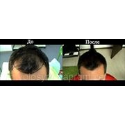 Лікування шкіри голови і проблем випадіння волосся в одесі, 3 перевірених постачальника послуг