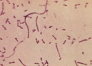 Haemophilus influenzae (гемофільна паличка) - культуральні та геномні властивості, морфологія і