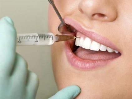 Чи можна при місячних лікувати зуби