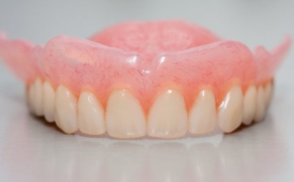 М'які зубні протези відгуки, фото, ціни