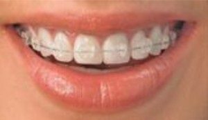 Smalto dental clinic - стоматологія на Кіпрі