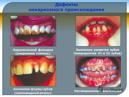 Презентація на тему кафедра пропедевтичної стоматології МДМСУ завідувач кафедри д