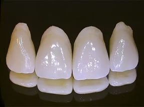 Звідки чорні точки на металокерамічних коронках чому болять металокерамічні зуби,