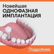 протезування зубів