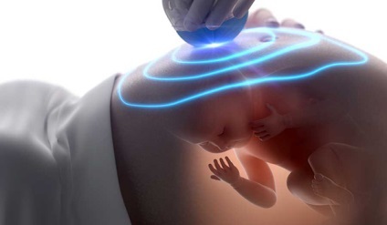 3D és 4D terhességi ultrahang - klinika altravita