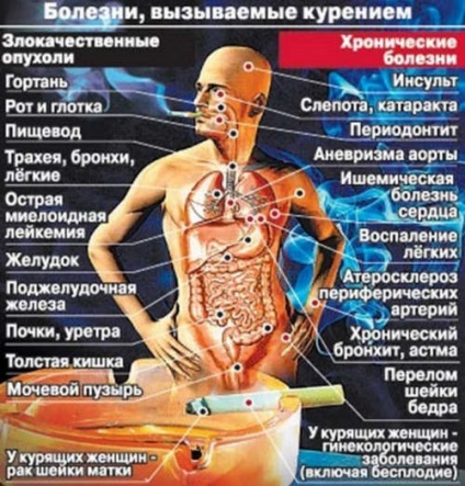 Dohányzásról - az egészségügyi beruházások №1