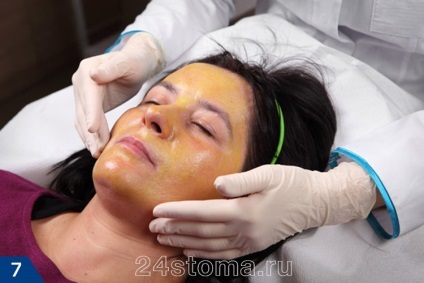 Dermabrasion személy - vélemények, fotók előtt és után