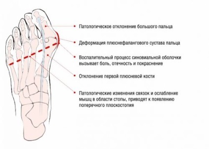 Lock a csontot a lábát felülvizsgálatát és módok alkalmazása