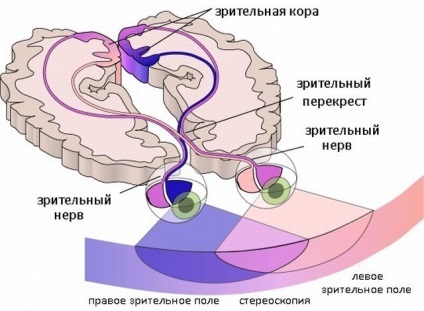 Hemianopsia (homonim, Geteronimnaja, bitemporalis) tünetek, a kezelés