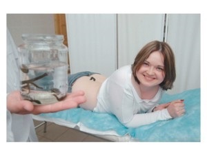 Hirudotherapy nőgyógyászati javallatok és ellenjavallatok, piócák, otthon és az ár (piócák) Hirudotherapy nőgyógyászati javallatok és ellenjavallatok, piócák otthon, és az árak