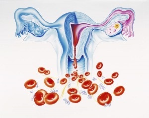 Közbeiktatott-subserous méh fibroid tünetek és a kezelés