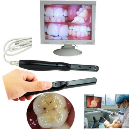 Intraorális kamera USB-csatlakozással egy laptop vagy egy TV (Csatlakozás egy laptop) Intraorális kamera USB kapcsolat a laptop vagy TV