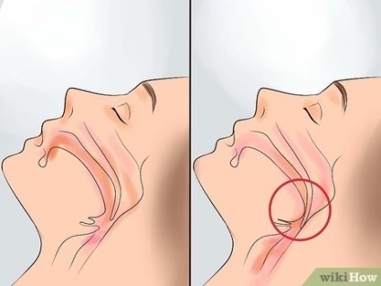 Hogyan kell kezelni a horkolás 1