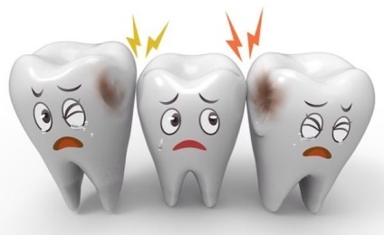Hogyan lehet megállítani a fogszuvasodást - a kezelési módszerek és a megelőzés