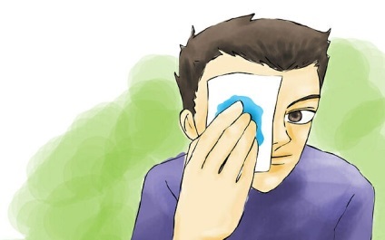 Hogyan lehet eltávolítani az árpa a szem