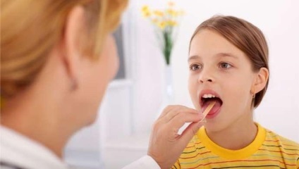 Hézagos mandulagyulladás a gyerekek, hogyan kell kezelni