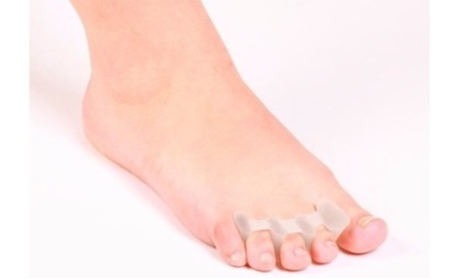 a lábujjak deformáló artrózisának kezelése)
