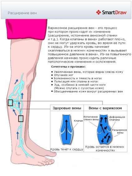 visszér kezelés klinikák Moszkva, árak, áttekintésre, kiválasztás phlebologist Online