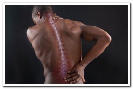 Myofascialis fájdalom szindróma - forrása krónikus fájdalom
