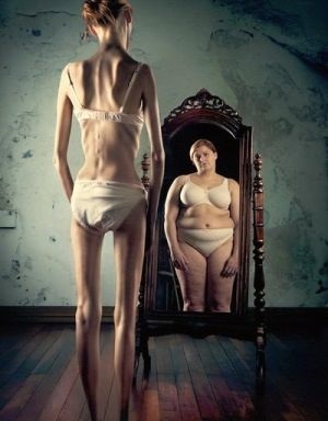 Anorexia nervosa okoz, szakaszában, a tünetek és a kezelés a szindróma
