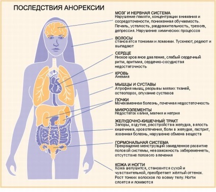 Anorexia nervosa okoz, szakaszában, a tünetek és a kezelés a szindróma