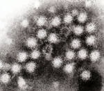 Norovirus fertőzés veszélyes betegség!