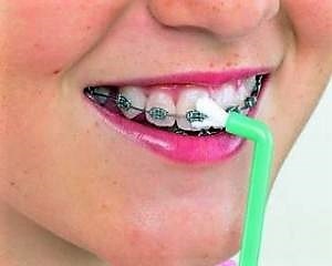 Fogszabályozó fogszabályozó fogkefe Oral B számára, hogyan kell tisztítani, vásárlás, ár
