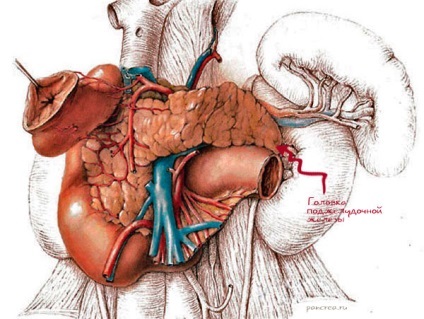 Pancreatitis, hasnyálmirigy fejét