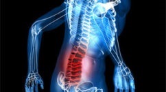 Csípőtáji törés tünetek, kezelés és a rehabilitáció a sérülés után
