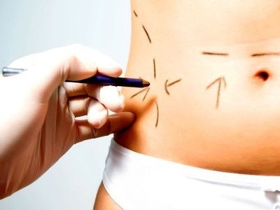 A következmények zsírleszívás tömörítés és zúzódások, mint káros és veszélyes sikertelen zsírleszívás