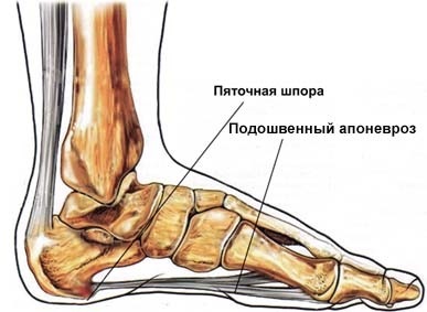 Calcaneus homlok - okai, tünetei és kezelése