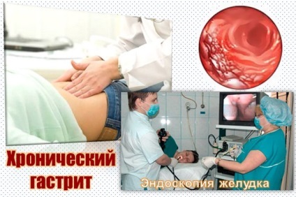 A tünetek a krónikus gastritis (tünetek krónikus gastritis) Tünetei krónikus gastritis