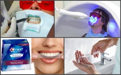 gyors fehérítő rendszer fogak fehér mosoly, mosoly brillante és egyéb