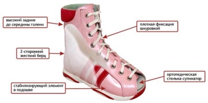 Складна ортопедичне взуття - як вибрати і замовити