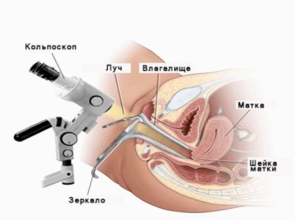 méhnyak terhességi ultrahang