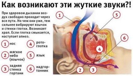 Women okai és kezelése A horkolás okai
