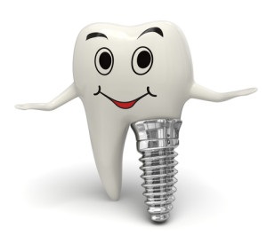 Melyek a fogászati ​​implantátumok