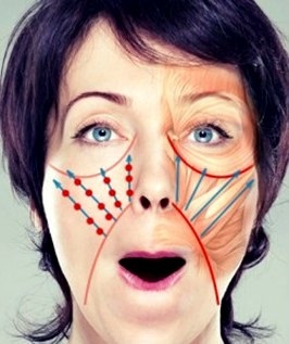 Hogyan lehet eltávolítani a arcon ráncok 3 egyszerű és hatékony módja a fiatalok test és a lélek (örökre