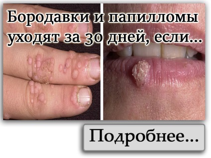 Twist láb nincs ereje, hogy kitartóbb légy! Nyújtsd a lábad fáj magából! Hasznos tippek (fájdalom) Twist láb nincs ereje, hogy kitartóbb légy! Nyújtsd a lábad fáj magából! hasznos tippeket