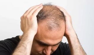 kezelésére haj és a fejbőr alopecia népi jogorvoslati - hírek - haj por