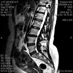 MRI a lumbosacral gerinc - és az ár jelzések