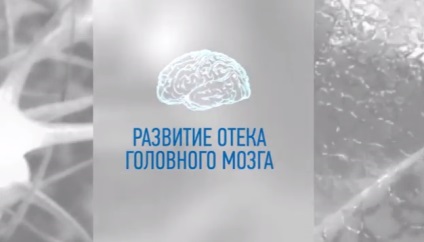 Duzzadást az agyban, a stroke prognózisa, a tünetek (a tünetek) Duzzanat az agy a stroke prognózisa, a tünetek