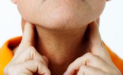 Szubakut pajzsmirigygyulladás tünetei és kezelése (thyroiditis) Szubakut pajzsmirigygyulladás tünetei és kezelése