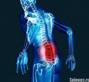 Mennyibe kerül egy MRI az lumbosacral gerinc