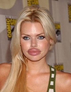 Azt akarom, ajkak, mint Angelina Jolie! (Ajak) Azt akarom, ajkak, mint Angelina Jolie!