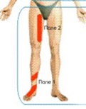 Almag elleni küzdelemben a cukorbetegség szövődményei (diabeteses polyneuropathia) Almag elleni küzdelemben a cukorbetegség szövődményei
