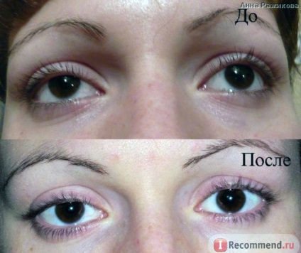Avon újra klinikai 2 az 1-ben a szem körüli bőr felülvizsgálata