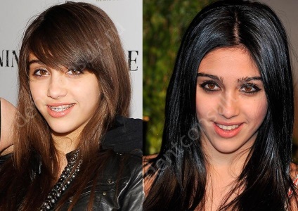 Braces csillagok és hírességek, fotók előtt és után (a csillagok) Braces csillagok és hírességek, fotók előtt és után
