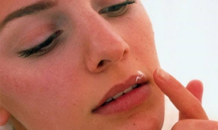 Gyakori herpesz az ajkak okait és kezelését